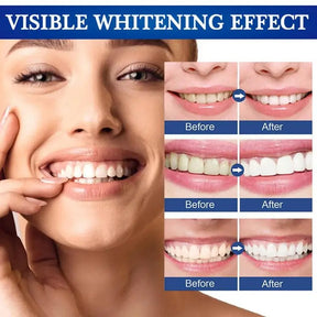 Dazzling White Instant Teeth Whitening Pen